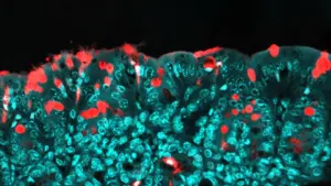 Mice Study Reveals How Food Additives Impact Child Health